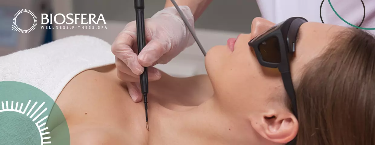 Удаление папиллом в MediSPA центр BIOSFERA Удаление папиллом
