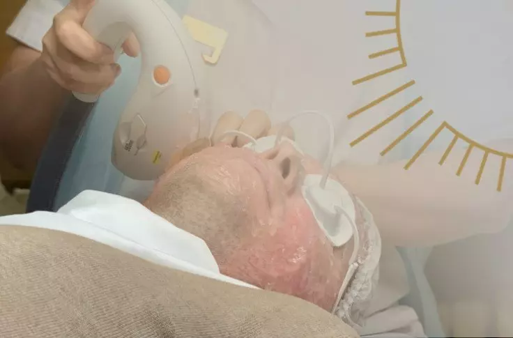 Лечение розацеа: современные решения от MediSPA центр BIOSFERA Лечение розацеа: современные решения
