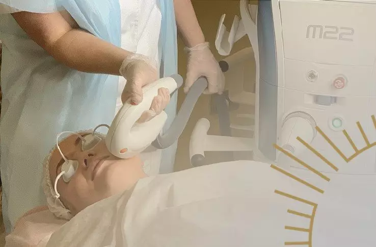 Как удалить сосудистые звездочки от MediSPA центр BIOSFERA Как удалить сосудистые звездочки